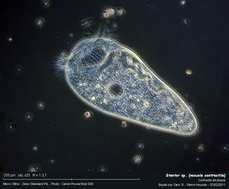 Stentor sp. #20465