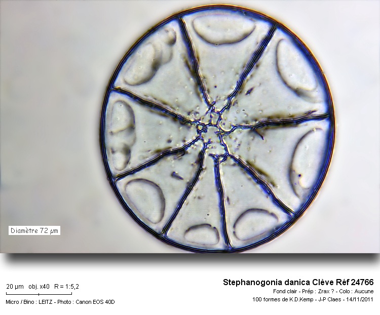 Stephanogonia danica #24657
