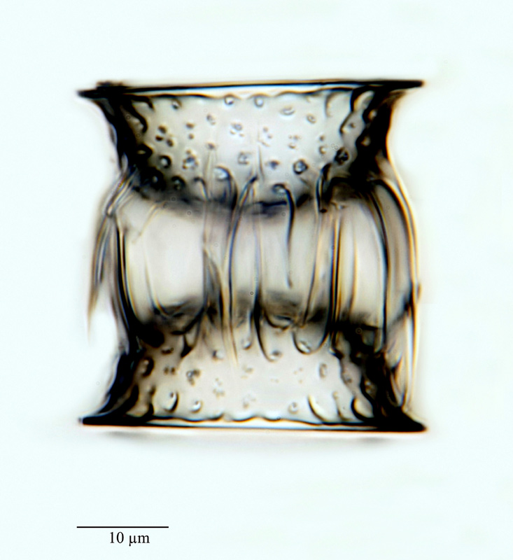 Stephanopyxis barbadensis Grev. #23618