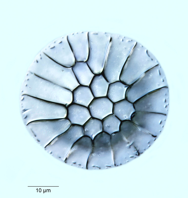 Stephanopyxis grossecellulata #53089