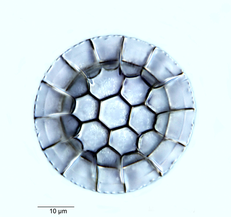 Stephanopyxis grossecellulata #53044