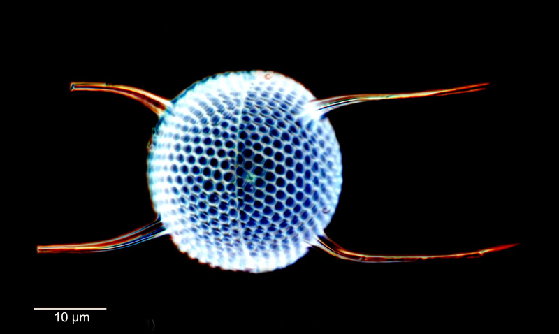 Stephanopyxis turris #80378