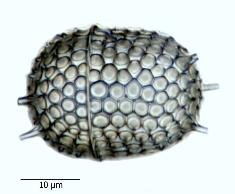 Stephanopyxis turris f. cylindrus #65746