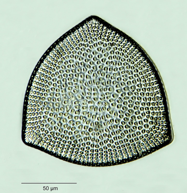 Stictodiscus gibbosus (Gr. & St.) Hustedt #35163