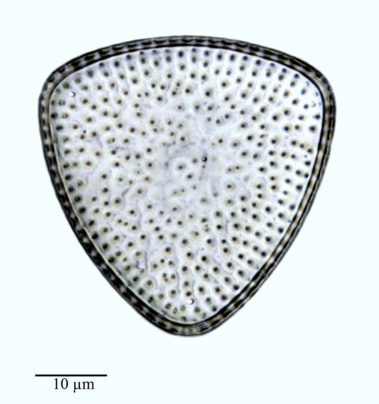 Stictodiscus parallelus var. gibbosa #64305