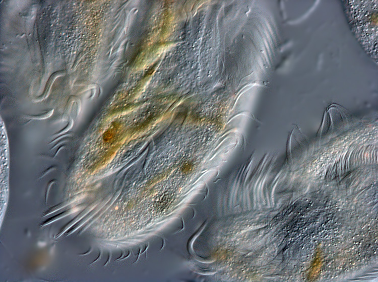 Stylonychia pustulata #4134