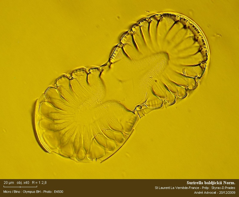 Surirella baldjickii Norm. #13790