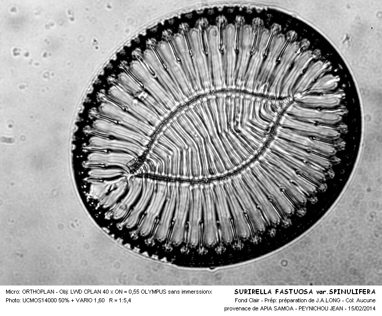 SURIRELLA FASTUOSA var.SPINULIFERA #36353