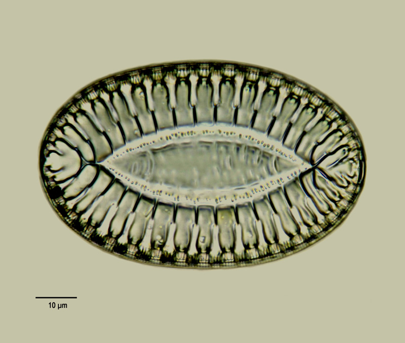 Surirella fastuosa #14651