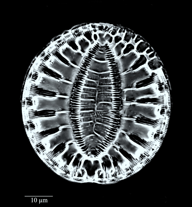 Surirella fastuosa #73396