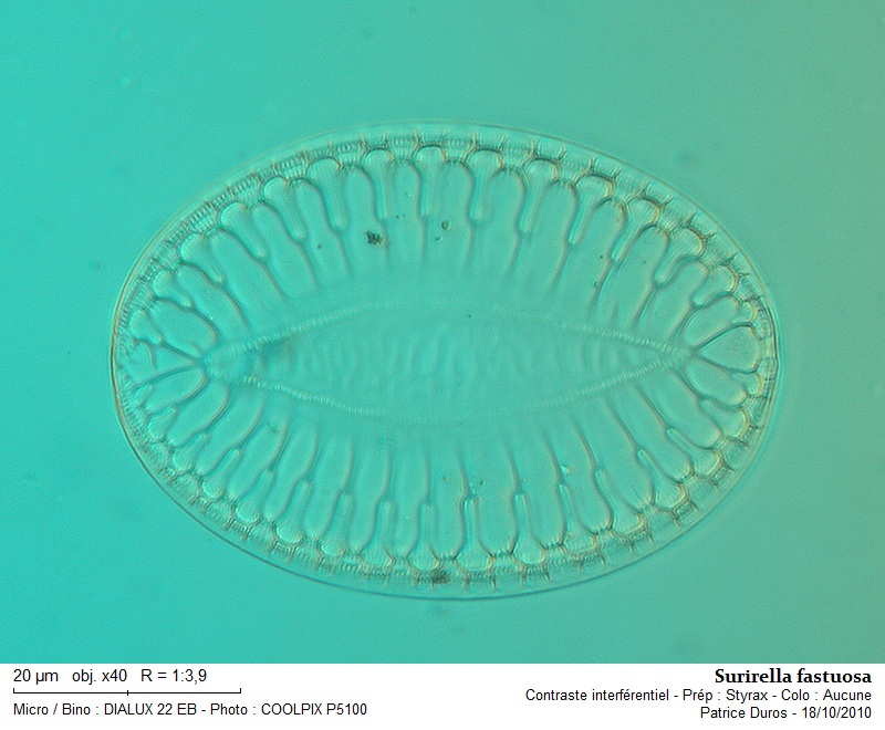Surirella fastuosa #18580