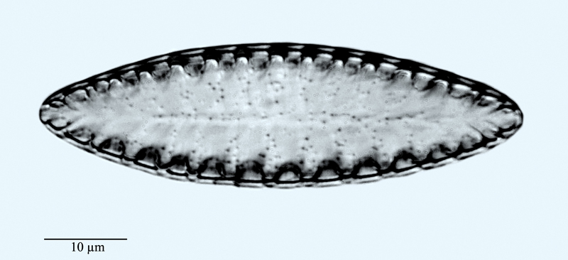 Surirella helvetica #47794