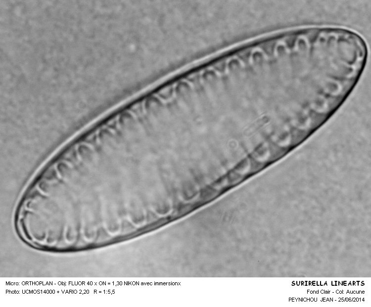 SURIRELLA LINEARIS #37994