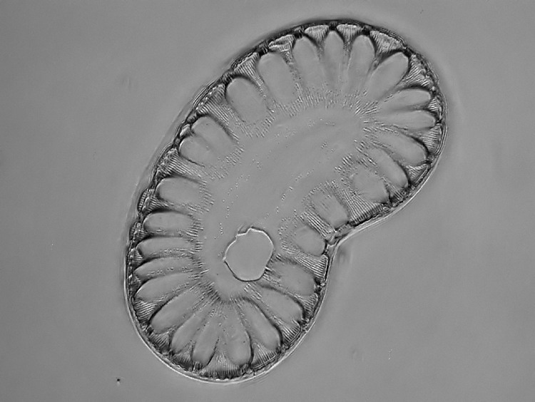 Surirella neumeyeri Janisch #17455