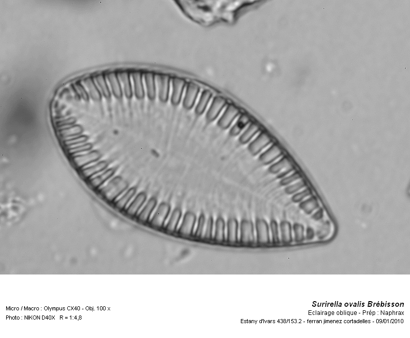 Surirella ovalis Brébisson #14043