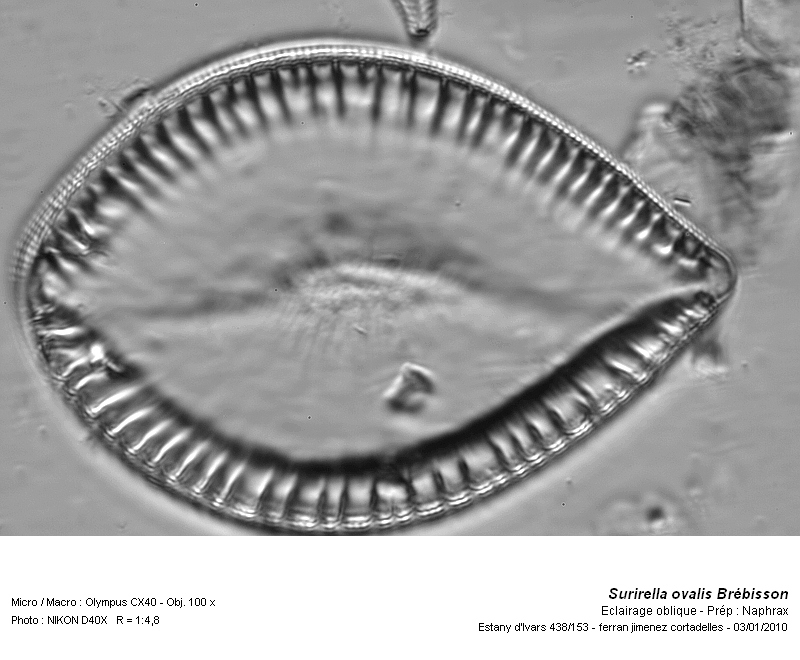 Surirella ovalis Brébisson #14042