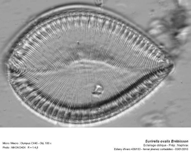 Surirella ovalis Brébisson #14044
