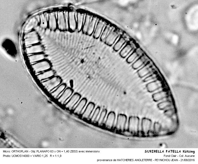 SURIRELLA PATELLA Kützing #46600