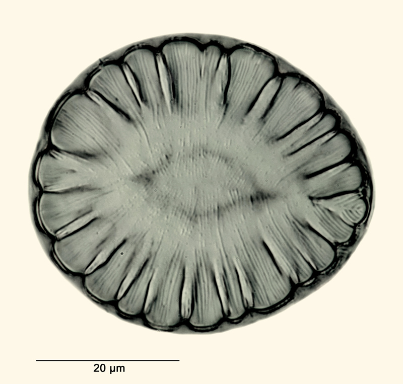 Surirella rotunda Pantocsek #30745