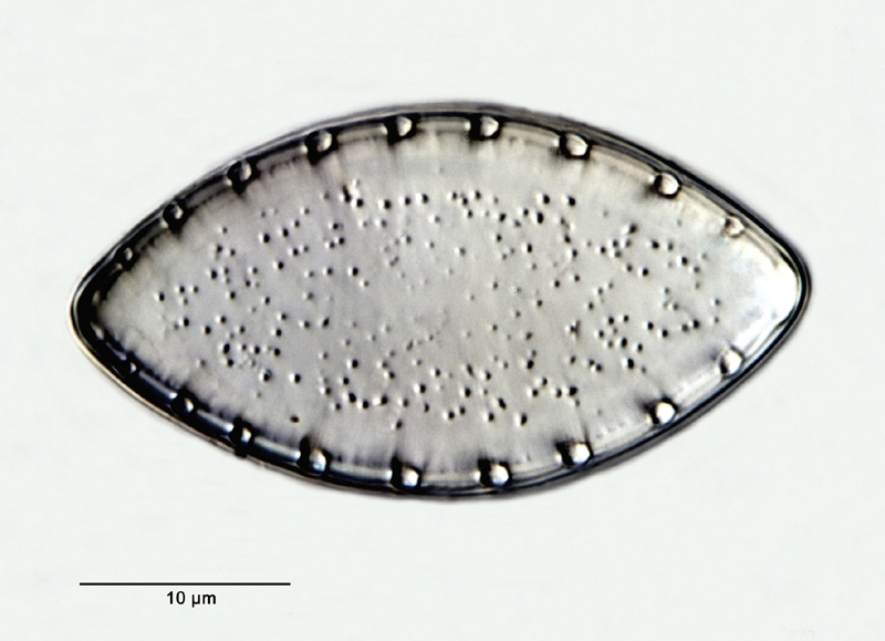 Surirella spinosa Hustedt #27174