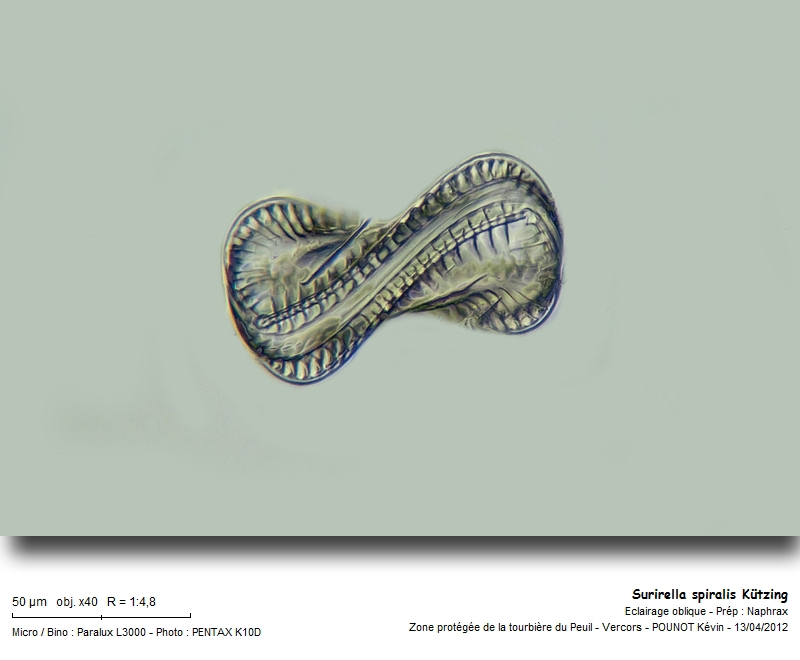 Surirella spiralis Kützing 1844 #26475