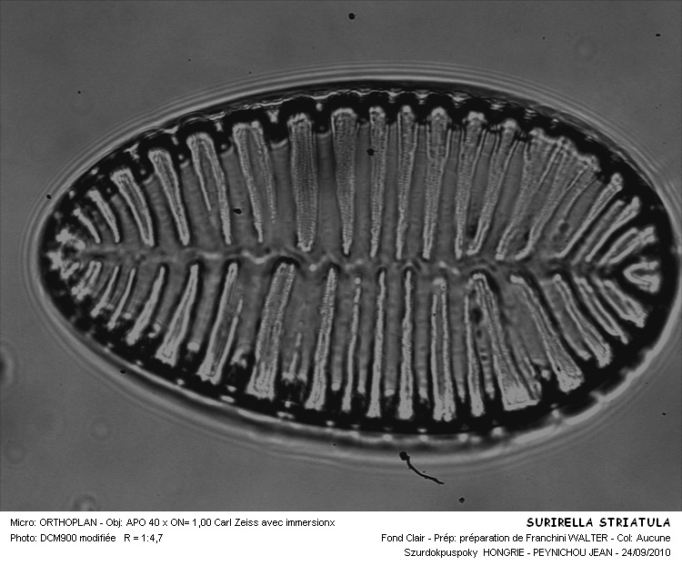 Surirella striatula Turpin #31558