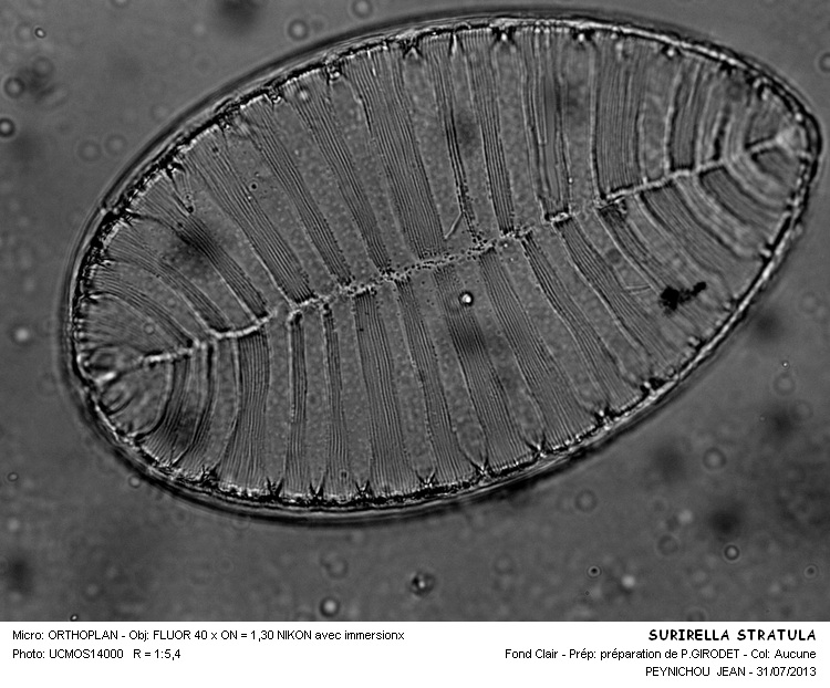 Surirella striatula Turpin #32977