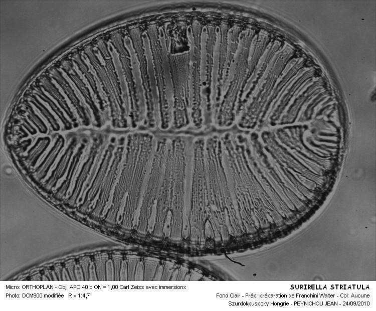 Surirella striatula Turpin #18167