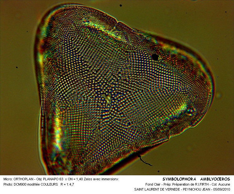 Symbolophora amblyoceros (Ehr.) Hasle & Sims #17941