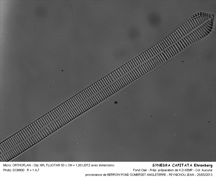SYNEDRA CAPITATA Ehrenberg #31362