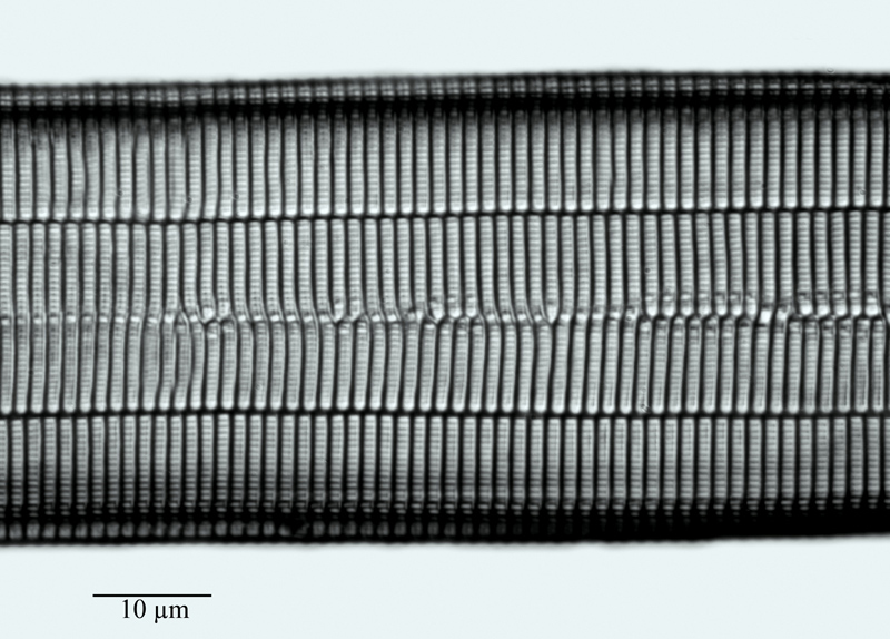 Synedra formosa #61457