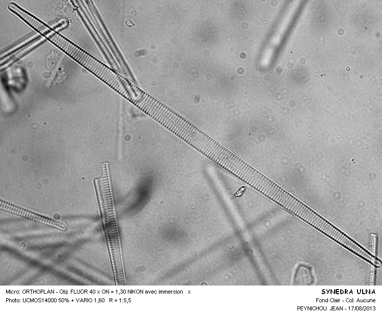 SYNEDRA ULNA #33348