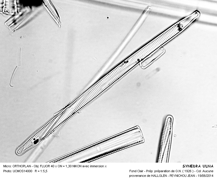SYNEDRA ULNA var. OXYRHYNCHUS Kutzïng #37934