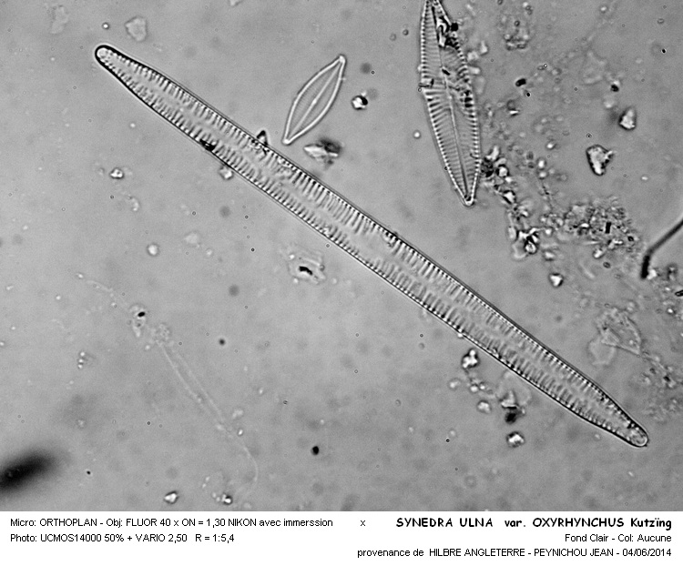SYNEDRA ULNA var. OXYRHYNCHUS Kutzïng #37747