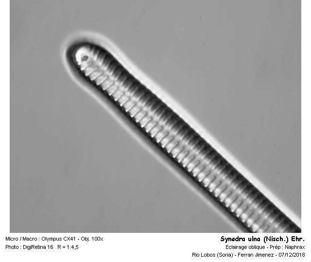 Synedra ulna (Nitzsch.) Ehr. #57245