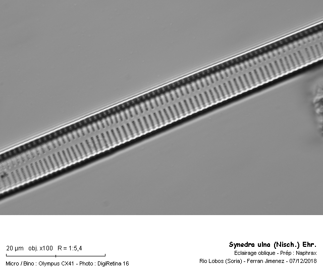 Synedra ulna (Nitzsch.) Ehr. #57244