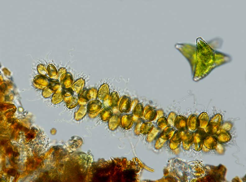 Synura uvella #6415