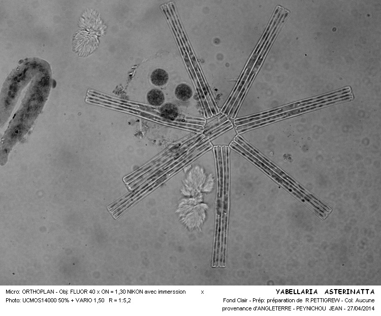 Tabellaria asterionella #37310