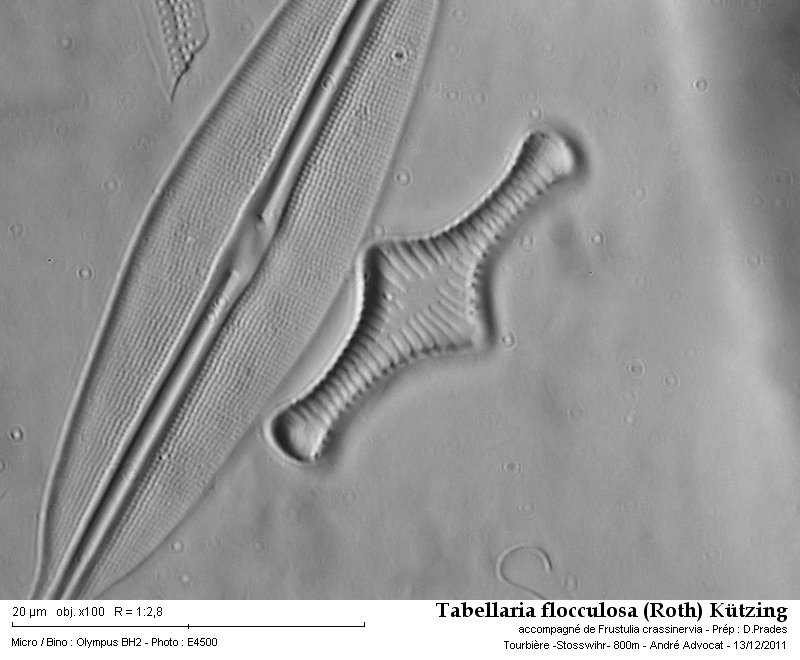Tabellaria flocculosa (Roth) Kütz. #25145