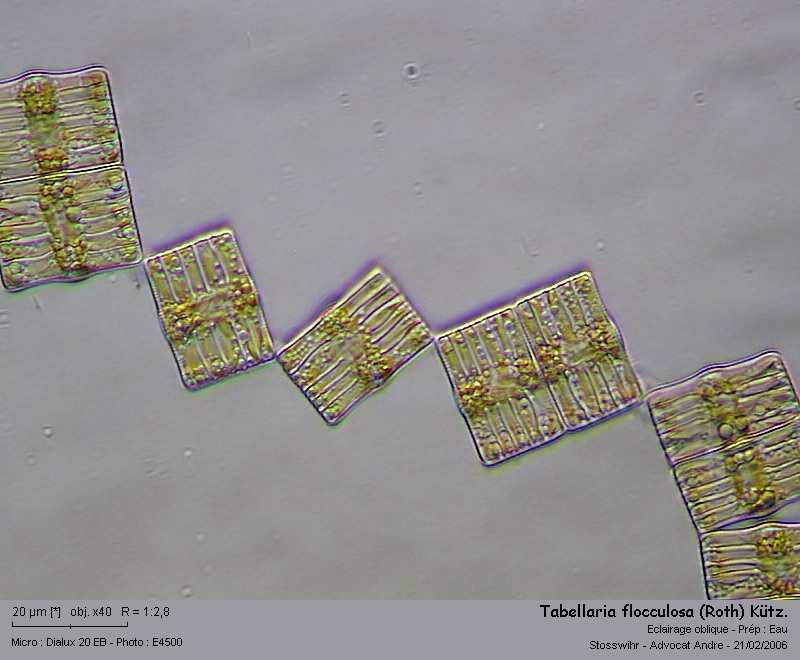Tabellaria flocculosa (Roth) Kütz. #2897