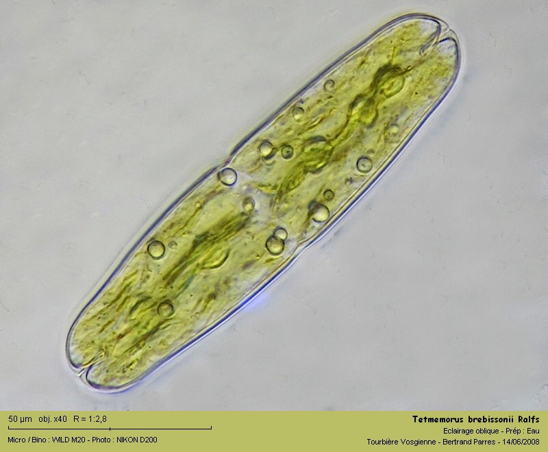 Tetmemorus brebissonii Ralfs #4699