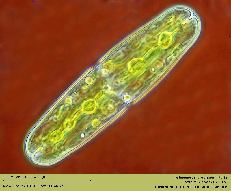 Tetmemorus brebissonii Ralfs #4700