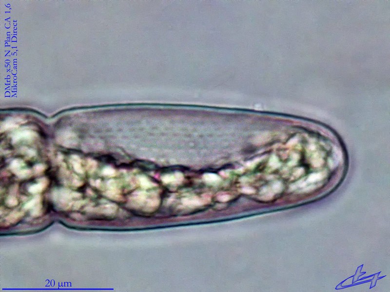 Tetmemorus flensburgii #84914