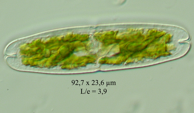 Tetmemorus laevis #60879
