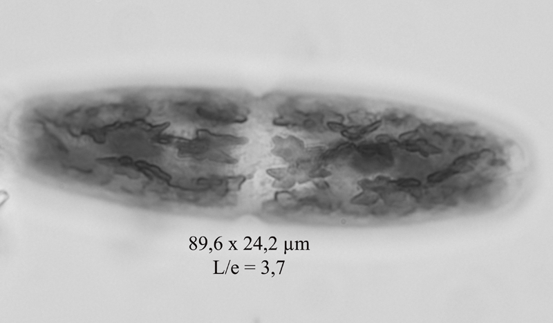 Tetmemorus laevis #60880