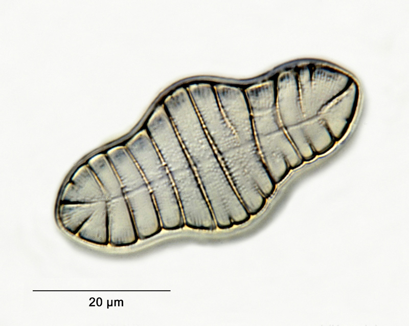 Tetracyclus lacustris var. compacta Hustedt #26430