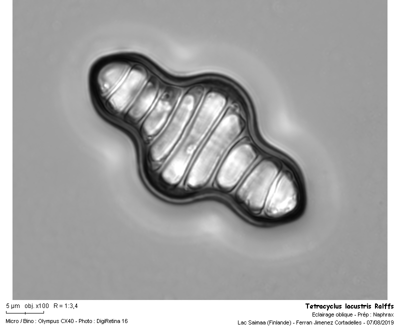 Tetracyclus lacustris Ralfs #63527