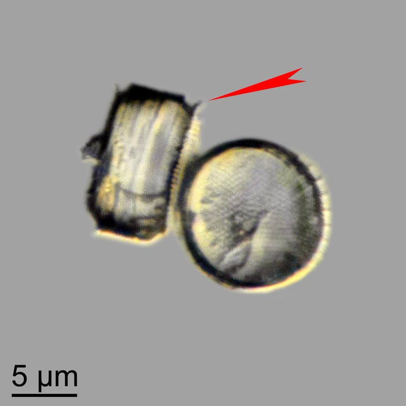 Thalassiosira #44649