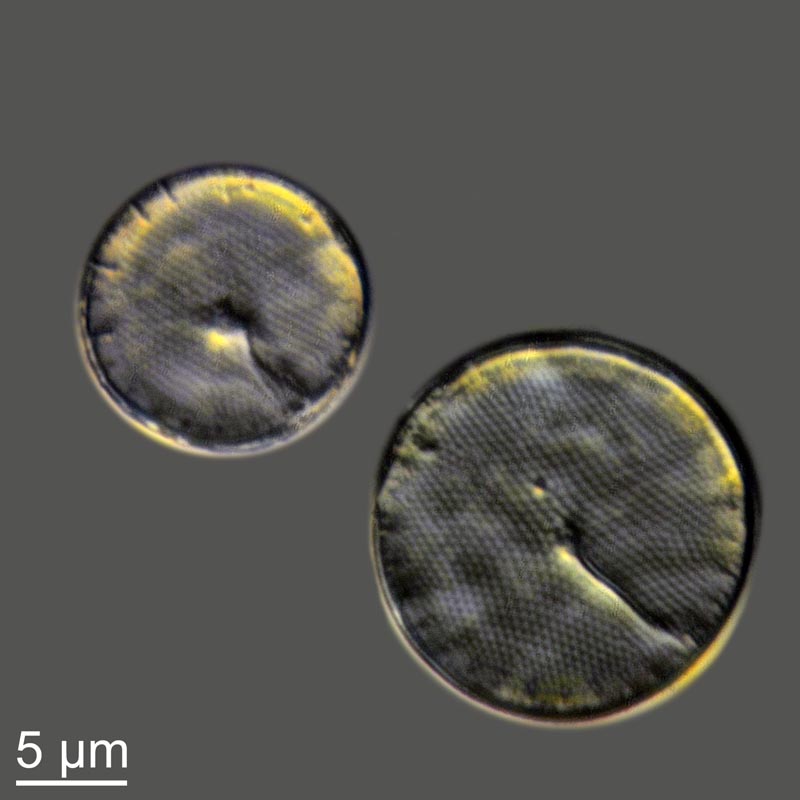 Thalassiosira #44652