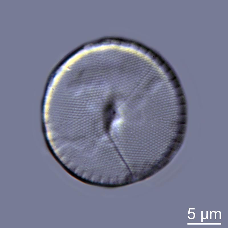 Thalassiosira #44651